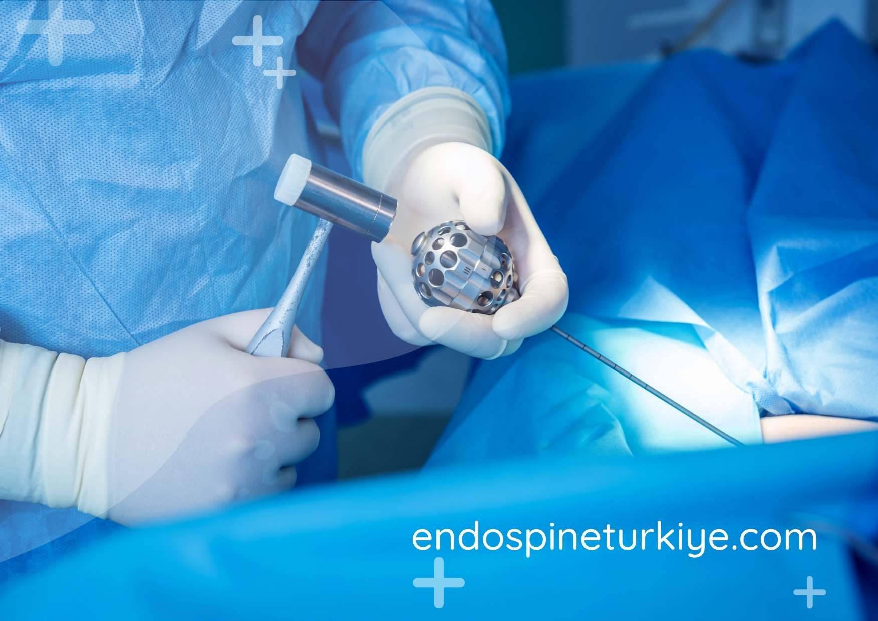 Endoskopik cerrahi giriş noktası - 0,6mm kesi