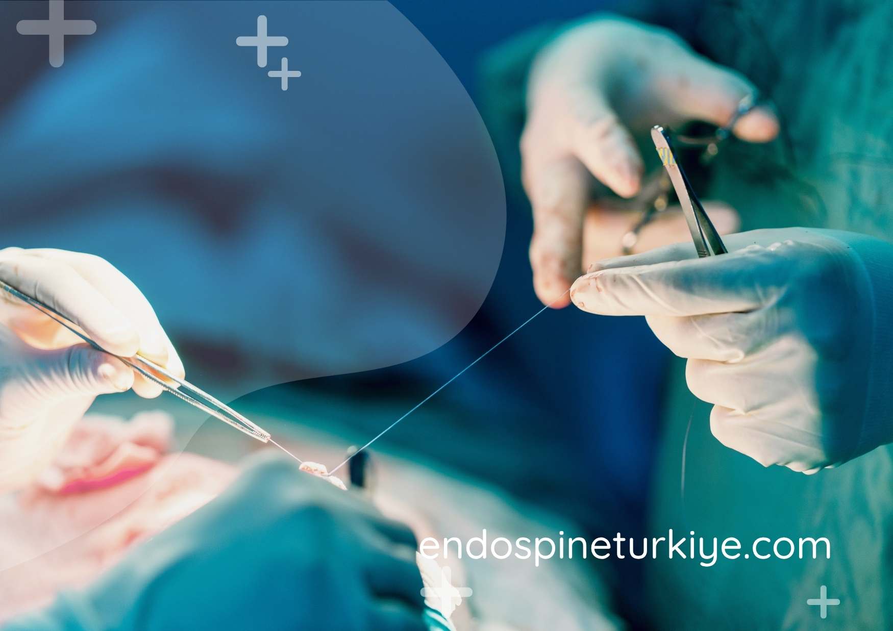 Hızlı İyileşme ile Kapalı Ameliyat